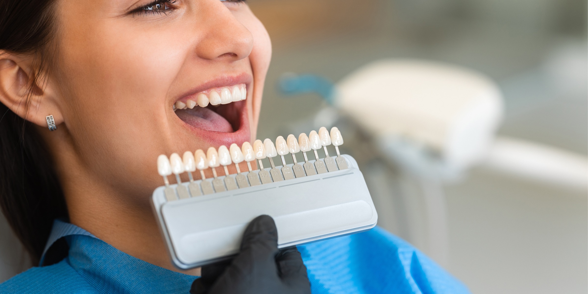 How Much do Veneers Cost