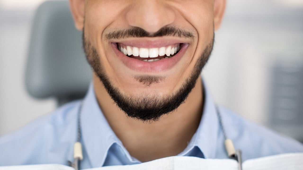 Veneers- Theyre More Affordable Than You Think_